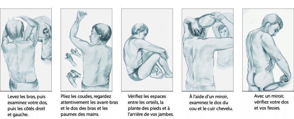 5-types-courants-de-cancer-et-leurs-symptômes-que-vous-devez-connaitre5