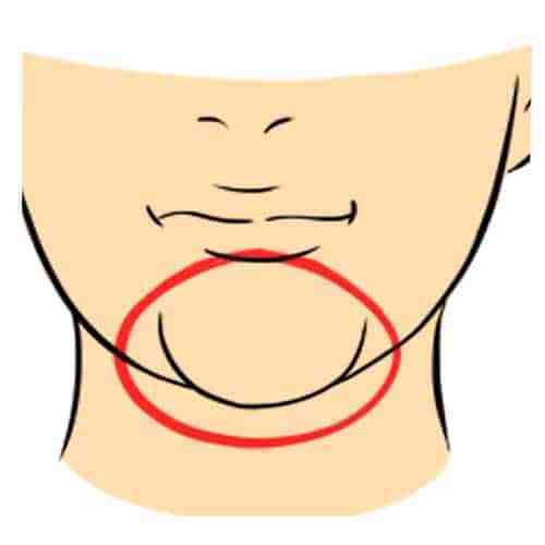 La forme de votre menton