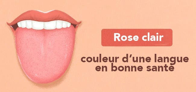 Les 13 choses que votre langue essaye de vous dire au sujet de votre santé