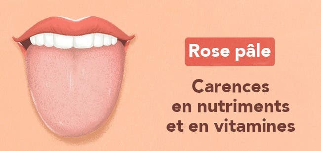 Les 13 choses que votre langue essaye de vous dire au sujet de votre santé