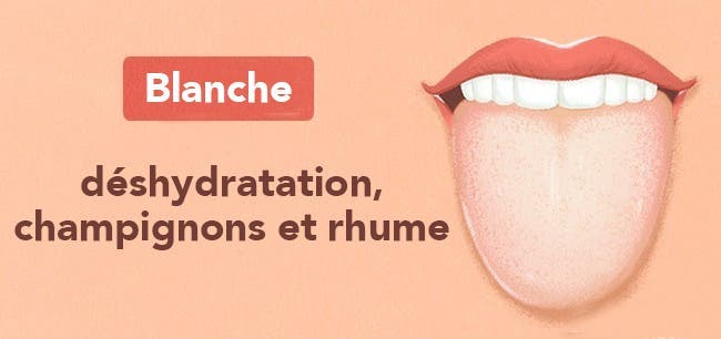 Les 13 choses que votre langue essaye de vous dire au sujet de votre santé