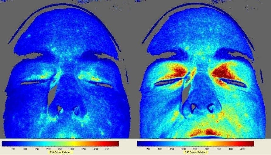 Marcher pieds nus est excellent pour la santé d’après des études