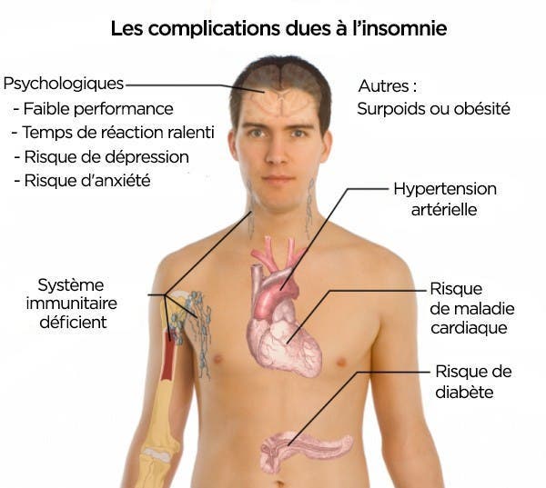 le-manque-de-cette-vitamine-peut-etre-la-cause-de-votre-insomnie